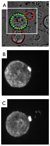 hiv-images002 med