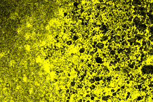 Coherent Anti-Stokes Raman Scattering