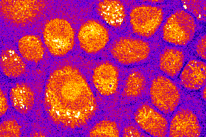 Coherent Anti-Stokes Raman Scattering