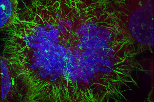 Structured Illumination Microscopy